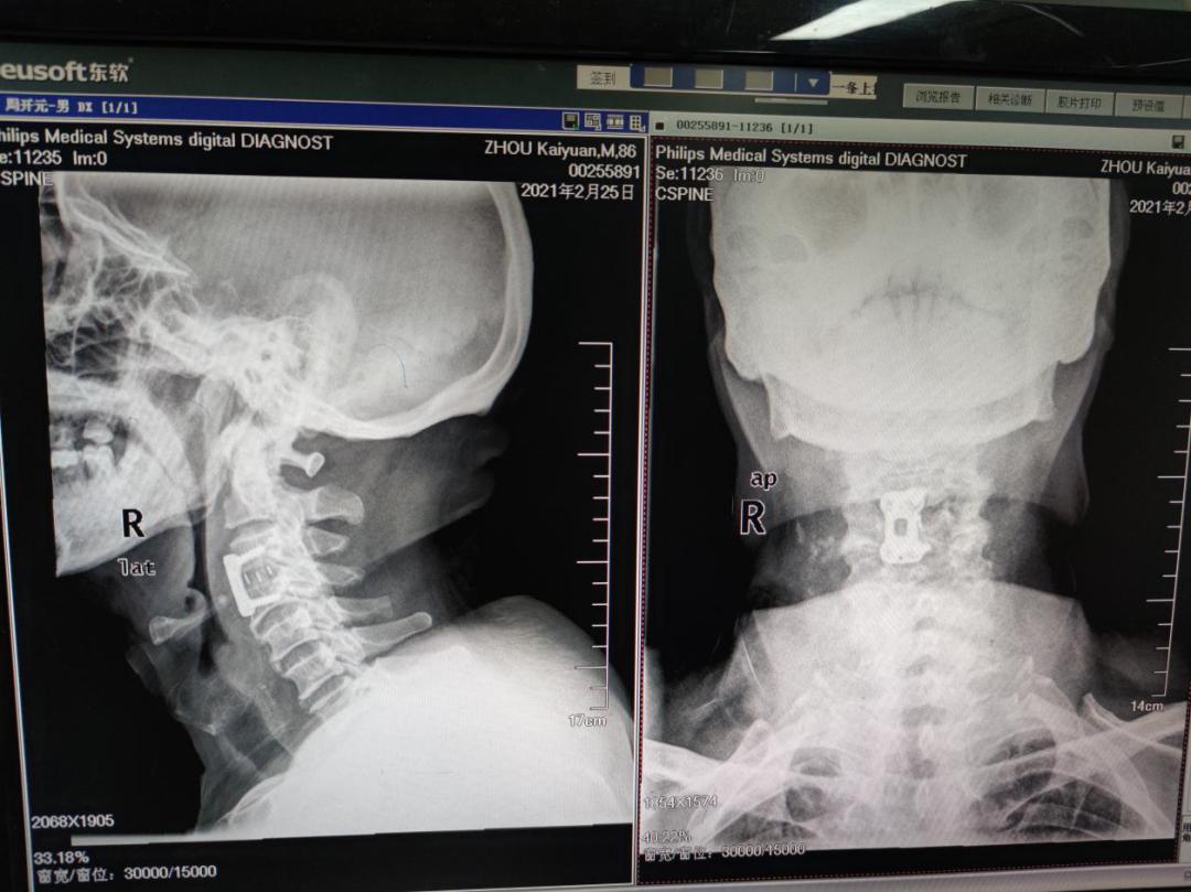 060270820dea41849cc9d39baa6f5451.png 060270820dea41849cc9d39baa6f5451.png